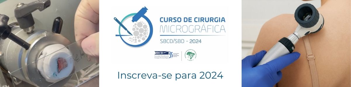 Curso de Cirurgia Micrográfica SBCD/SBD 2024
